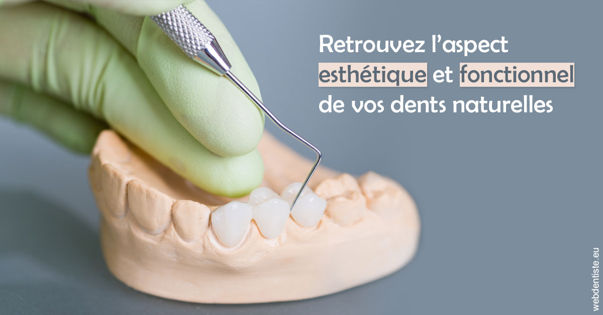 https://www.cabinet-dentaire-hollender-raybaut.fr/Restaurations dentaires 1