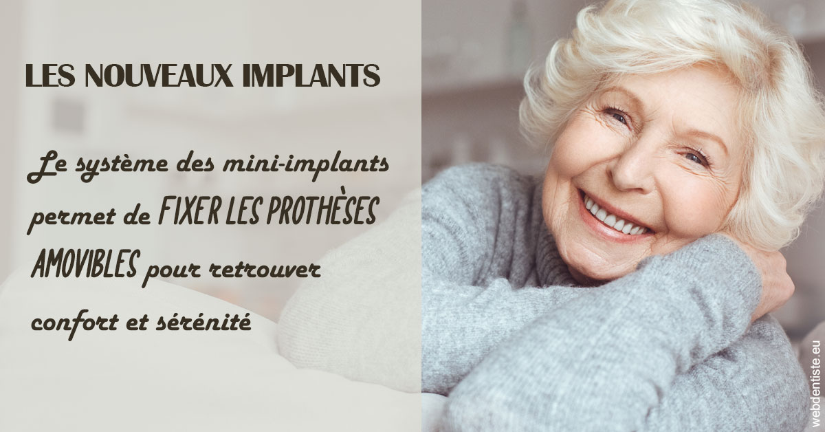 https://www.cabinet-dentaire-hollender-raybaut.fr/Les nouveaux implants 1