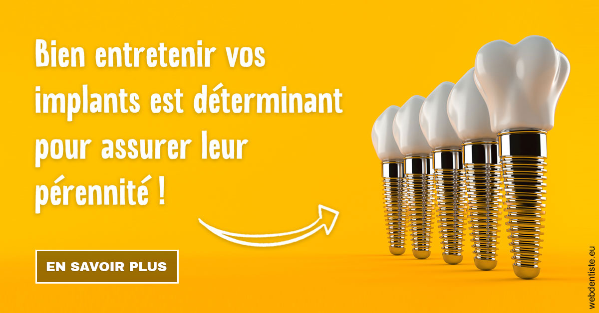 https://www.cabinet-dentaire-hollender-raybaut.fr/Entretien implants 2