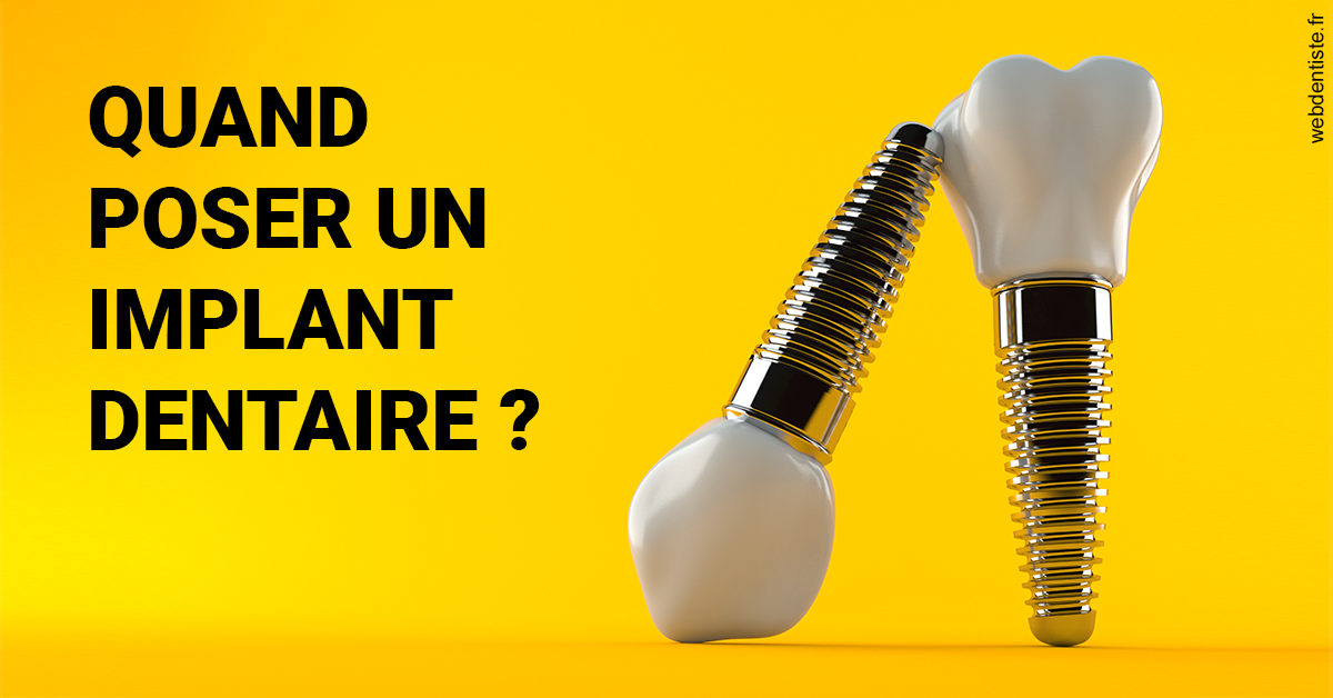 https://www.cabinet-dentaire-hollender-raybaut.fr/Les implants 2
