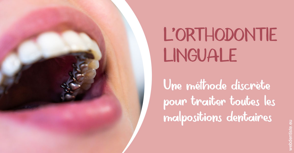 https://www.cabinet-dentaire-hollender-raybaut.fr/L'orthodontie linguale 2