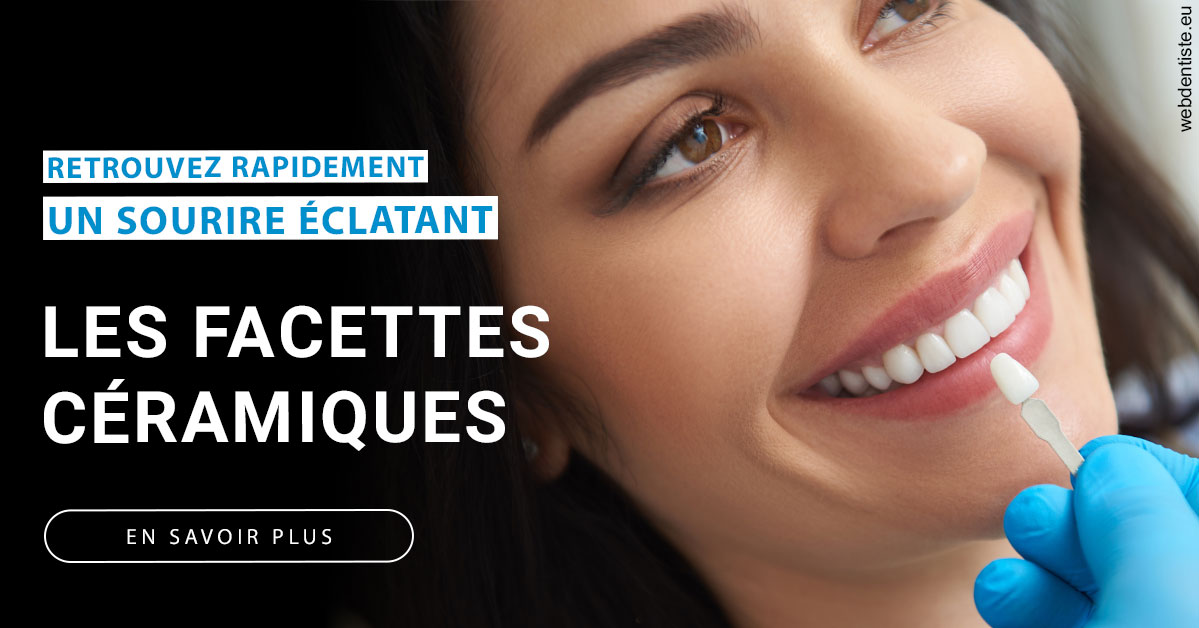 https://www.cabinet-dentaire-hollender-raybaut.fr/Les facettes céramiques 1