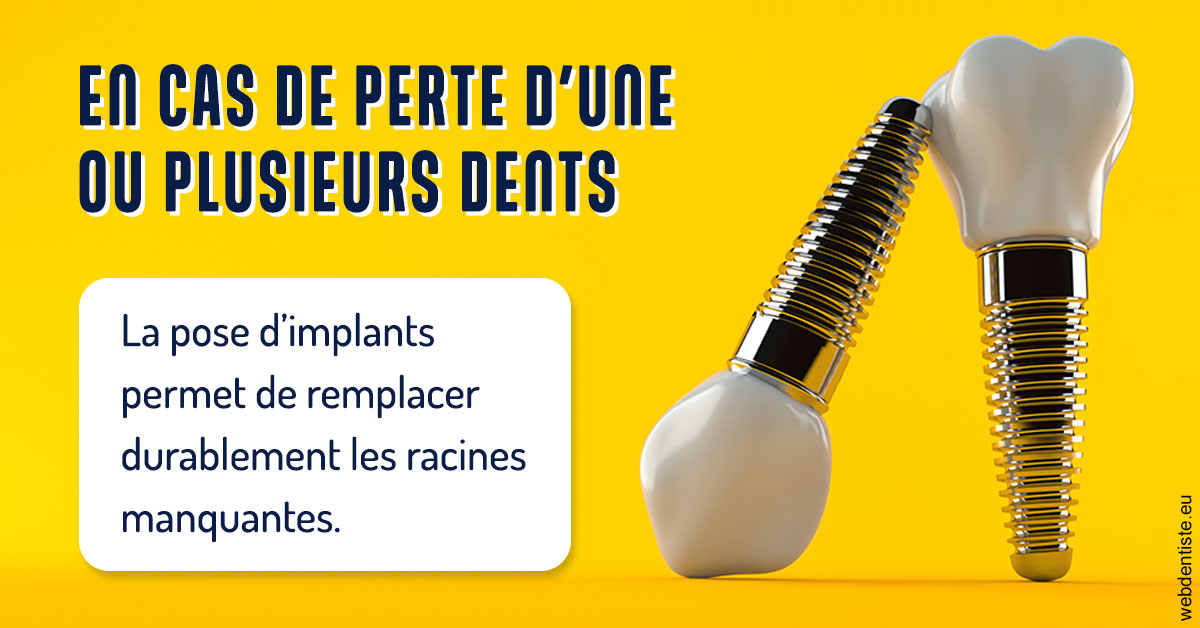 https://www.cabinet-dentaire-hollender-raybaut.fr/2024 T1 - Implants 02