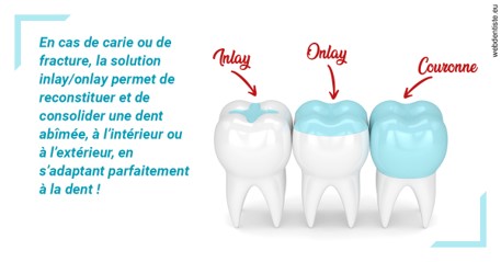 https://www.cabinet-dentaire-hollender-raybaut.fr/L'INLAY ou l'ONLAY