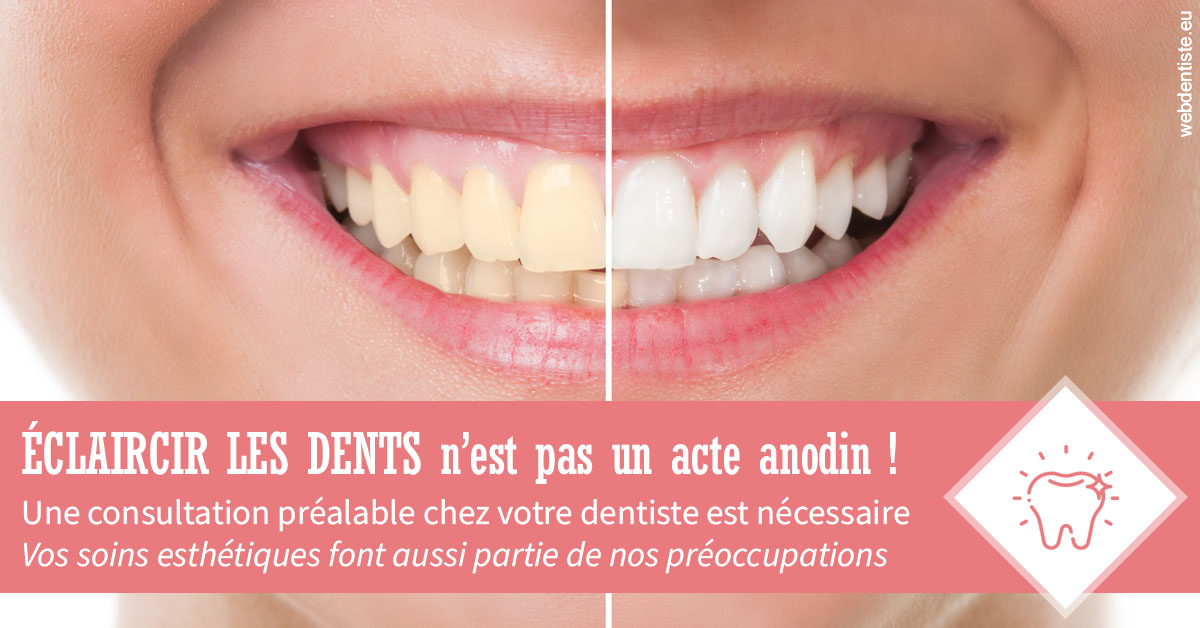 https://www.cabinet-dentaire-hollender-raybaut.fr/Eclaircir les dents 1