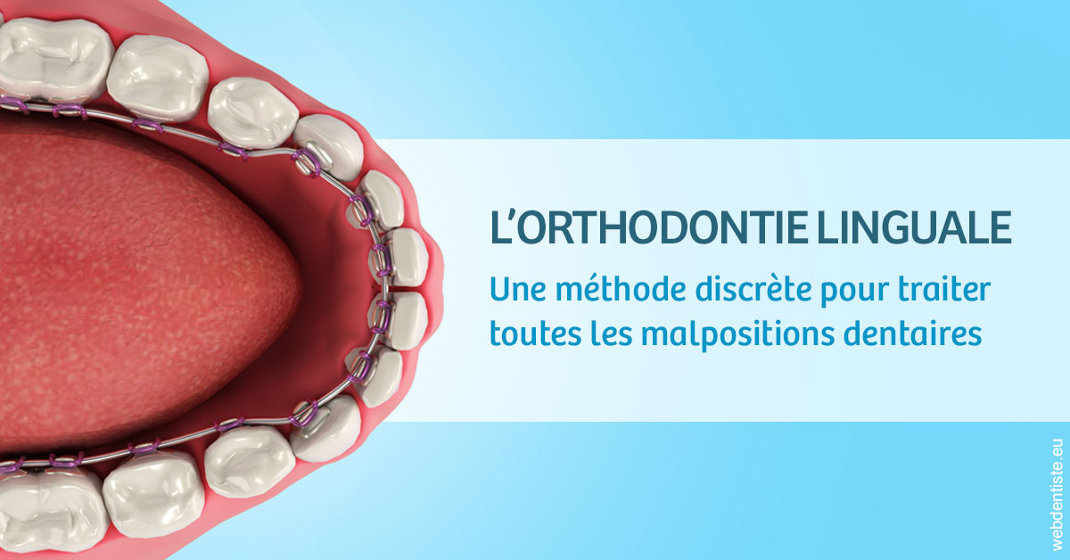 https://www.cabinet-dentaire-hollender-raybaut.fr/L'orthodontie linguale 1