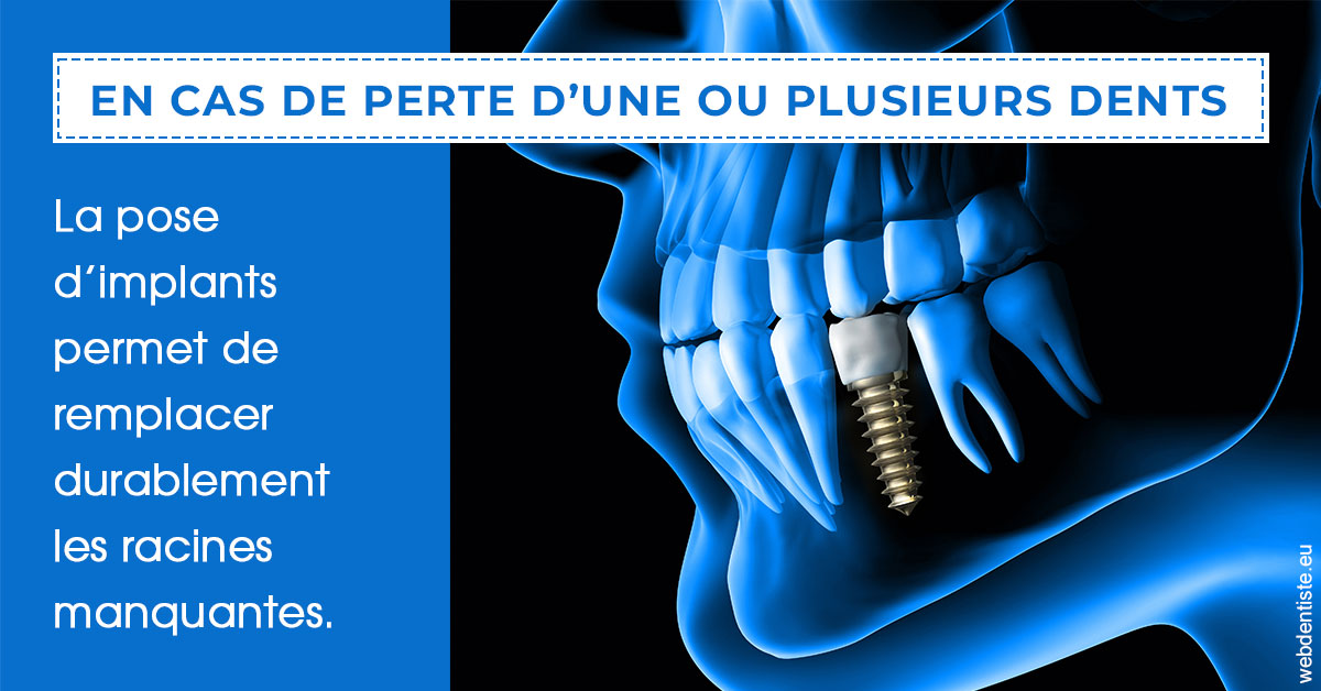 https://www.cabinet-dentaire-hollender-raybaut.fr/2024 T1 - Implants 01