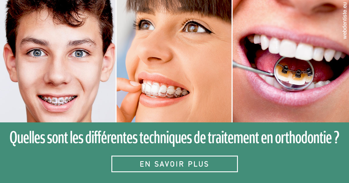 https://www.cabinet-dentaire-hollender-raybaut.fr/Les différentes techniques de traitement 2