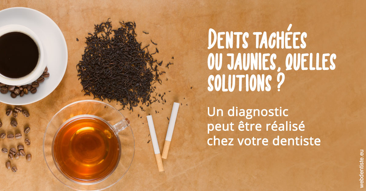 https://www.cabinet-dentaire-hollender-raybaut.fr/Dents tachées 2