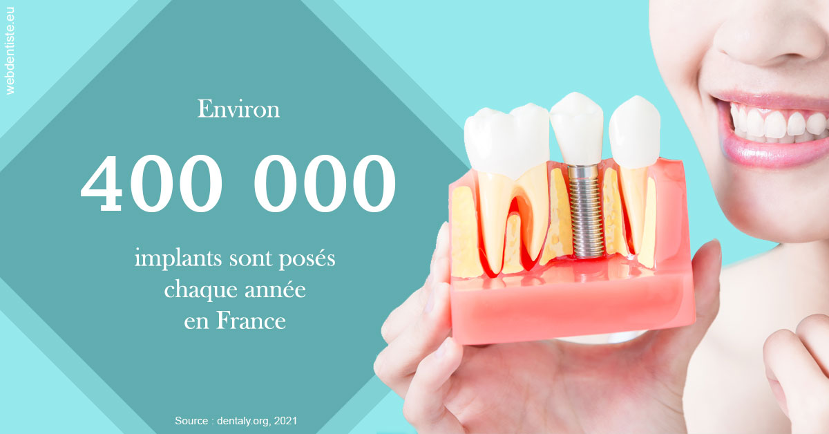 https://www.cabinet-dentaire-hollender-raybaut.fr/Pose d'implants en France 2