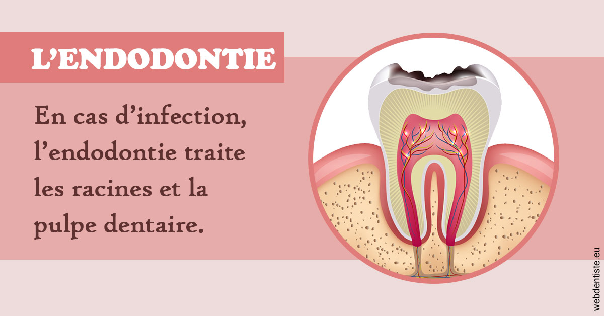 https://www.cabinet-dentaire-hollender-raybaut.fr/L'endodontie 2