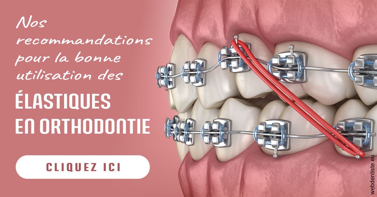 https://www.cabinet-dentaire-hollender-raybaut.fr/Elastiques orthodontie 2